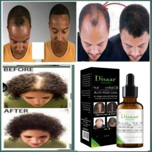 Disaarለተመለጠ ለሳሳ ፀጉር