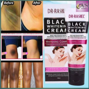 Black Whitening የጠቆረ ቆዳ ያስተካክላል